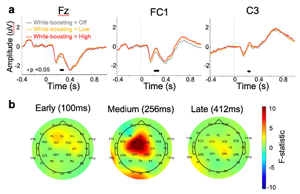 Representative figure for Quantifying objective and perceived image quality through EEG and eye-tracking